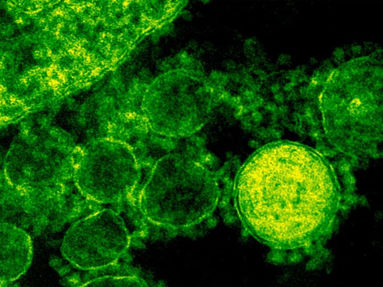 A microscopic image of MERS virus